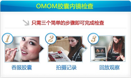 什么叫纳米胃镜胃部检查方法都有哪些？_https://www.jmylbn.com_新闻资讯_第14张